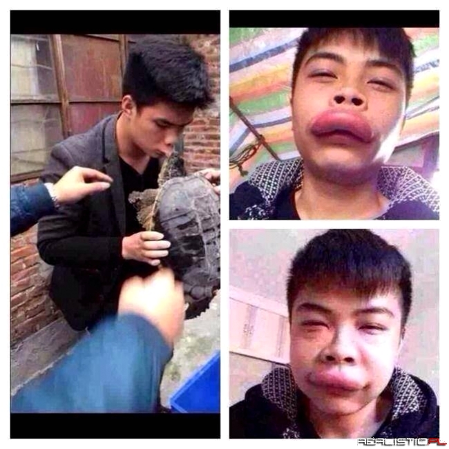 Tak wygląda efekt ugryzienia żółwia