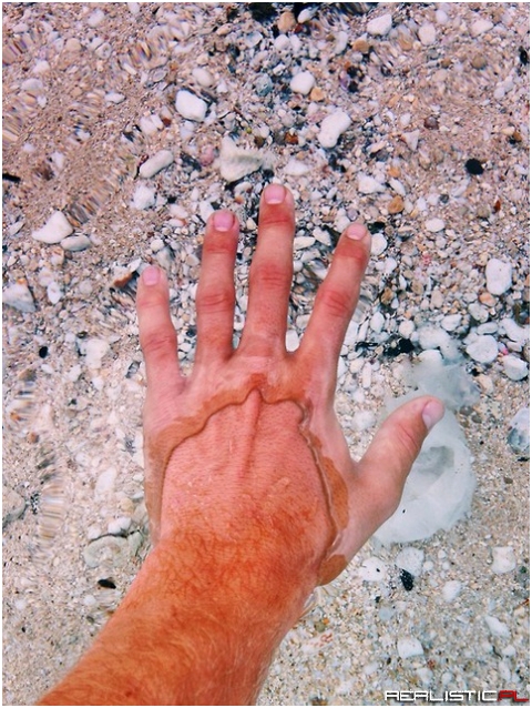 wtf is wrong with his hand lol