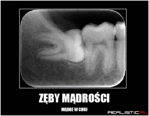 Zęby mądrości