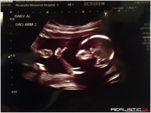 Already Showing a Positive Attitude