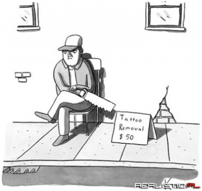 Tattoo removal