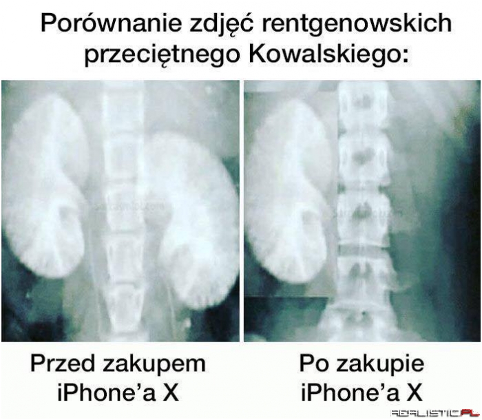 Przed i po ;)