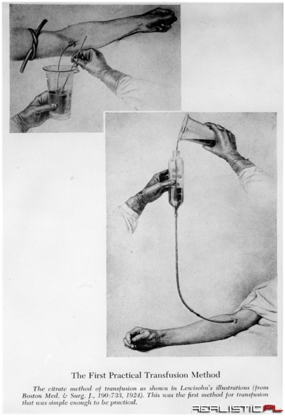 Pierwsze transfuzje krwi