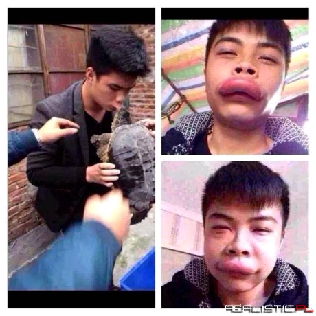 Tak wygląda efekt ugryzienia żółwia