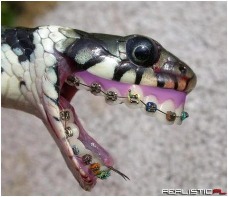 Snake with braces